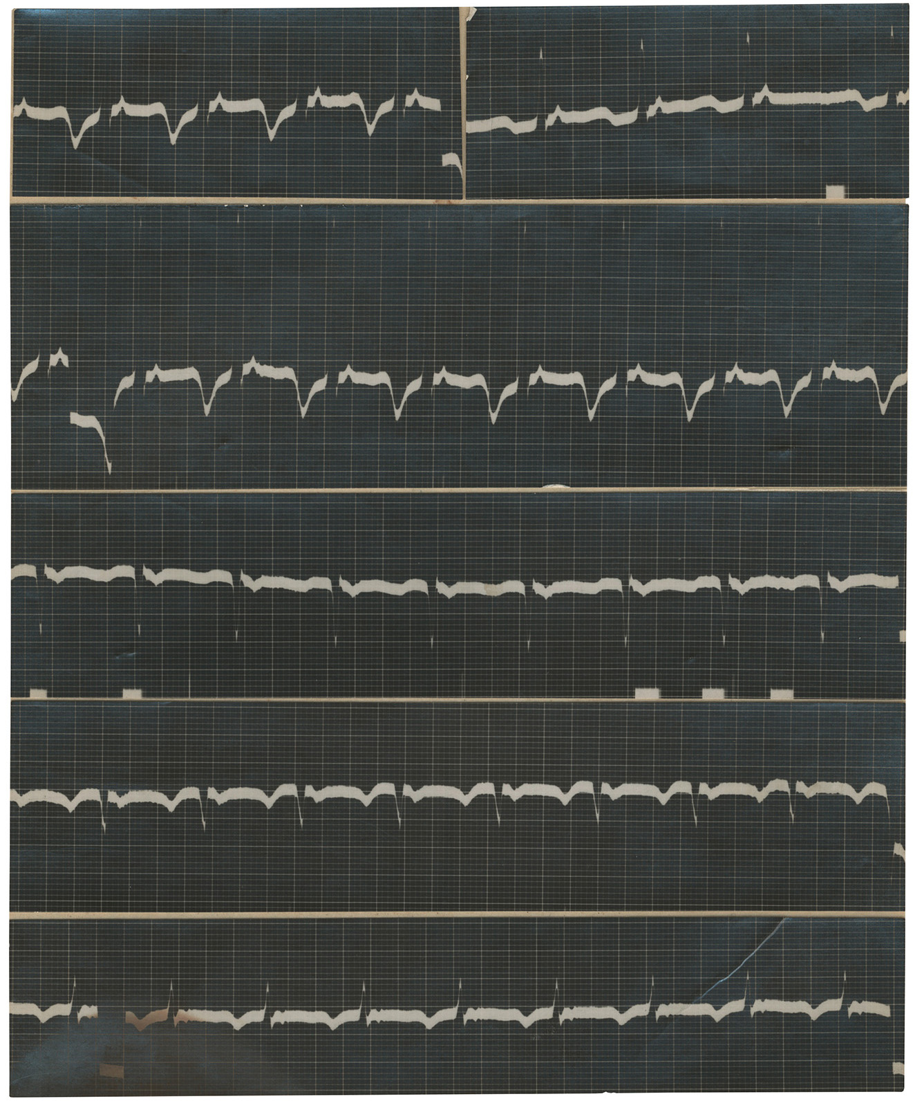 Object #97 / Electrocardiogram of Arnold Schönberg 